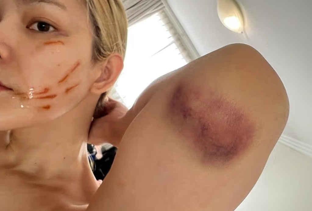 “你好了没？”疑因洗手间催门起争执，澳网红被打！华女涉伤人遭控罪（组图） - 7