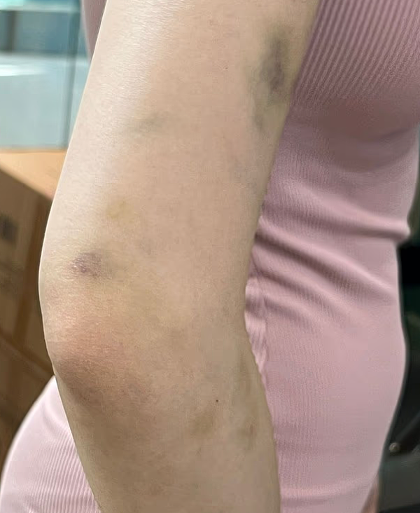 “你好了没？”疑因洗手间催门起争执，澳网红被打！华女涉伤人遭控罪（组图） - 9