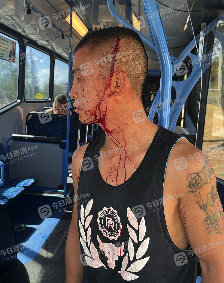 “滚出我们的国家！”澳洲华人拳王无端遭原住民袭击，铁锤爆头浑身血！妻子亦被围殴，“这里不再安全”（视频/组图） - 1