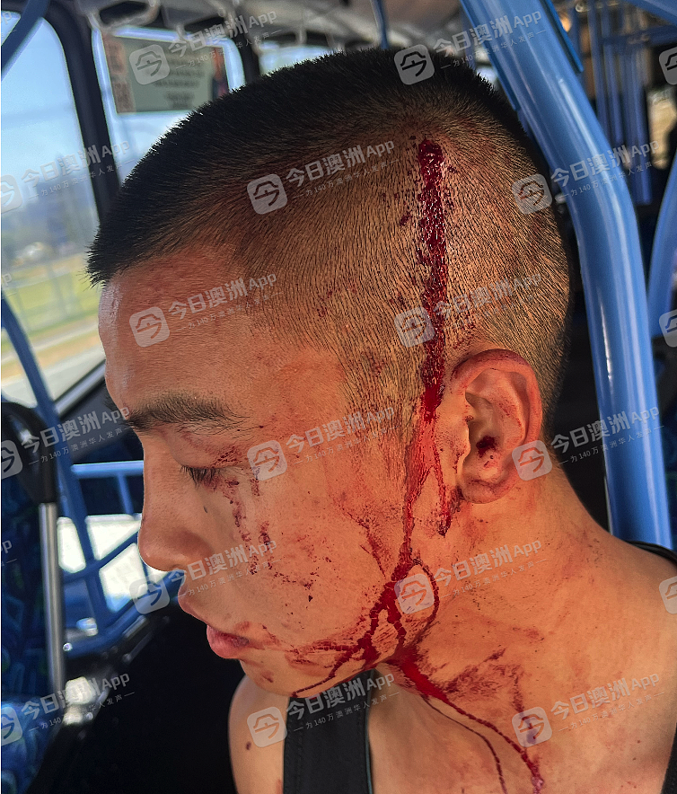“滚出我们的国家！”澳洲华人拳王无端遭原住民袭击，铁锤爆头浑身血！妻子亦被围殴，“这里不再安全”（视频/组图） - 2