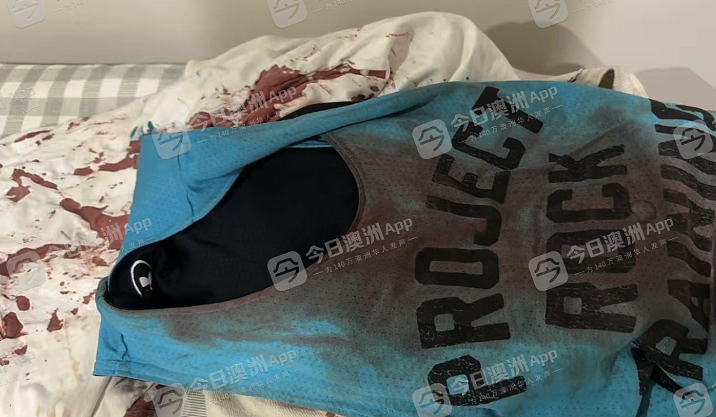 “滚出我们的国家！”澳洲华人拳王无端遭原住民袭击，铁锤爆头浑身血！妻子亦被围殴，“这里不再安全”（视频/组图） - 3