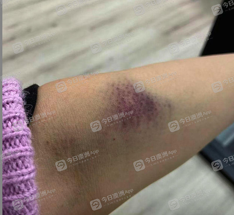 “我的孩子连草都不如!”工人擅闯民宅强行施工,澳洲华人高龄孕妇惨流产!批警方不作为,“我们被忽悠了”(组图) - 3