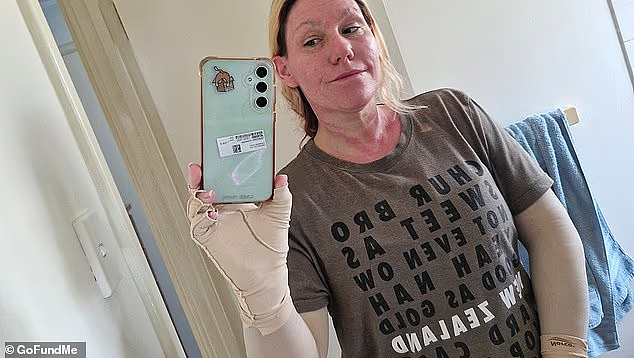 珀斯恐怖纵火案！女子汽车遭燃烧弹袭击，全身25%重度烧伤（组图） - 4