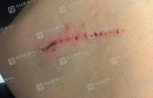 “怕他追出来捅我！”悉尼华男合租纠纷，室友竟持刀堵门！被逼浴室钻窗逃生，“很窝囊很委屈”（组图） - 5