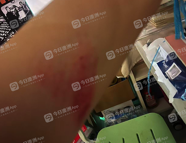 “怕他追出来捅我！”悉尼华男合租纠纷，室友竟持刀堵门！被逼浴室钻窗逃生，“很窝囊很委屈”（组图） - 4