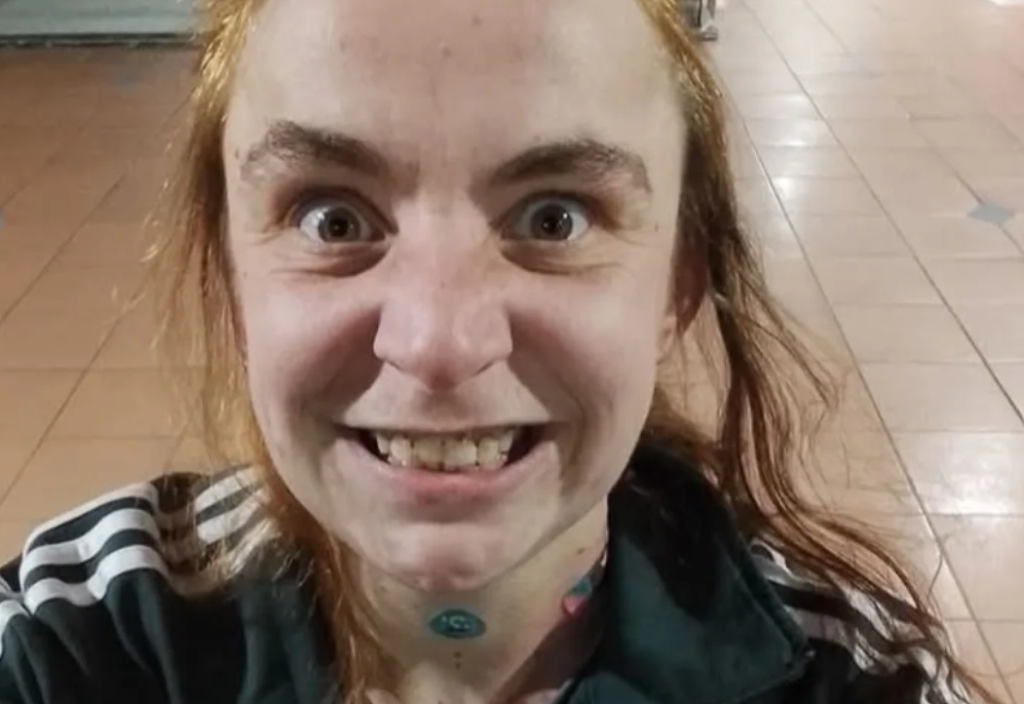 澳华女在CBD街头被随机捅伤!政府补助恐等半年,康复治疗全靠自掏腰包(组图) - 5