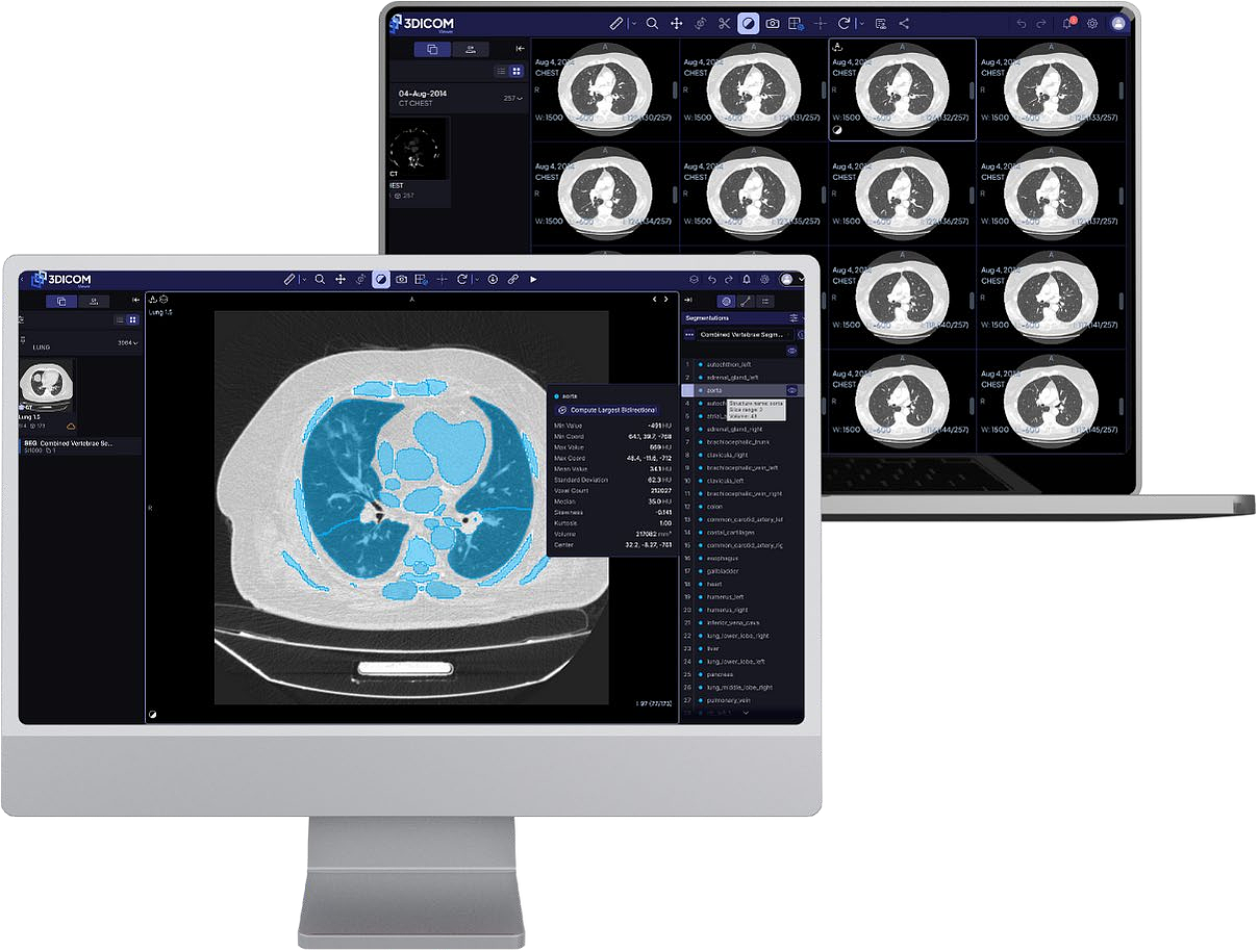 ASX：SHG - 3DICOM MD™ Cloud 的 FDA 510(k) 提交申请（组图） - 1