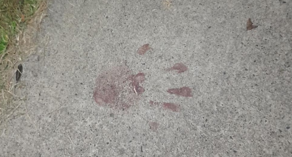 澳民宅发生捅人案！男子被刺生命垂危，车道留下血手印，邻居被吓坏（组图） - 5