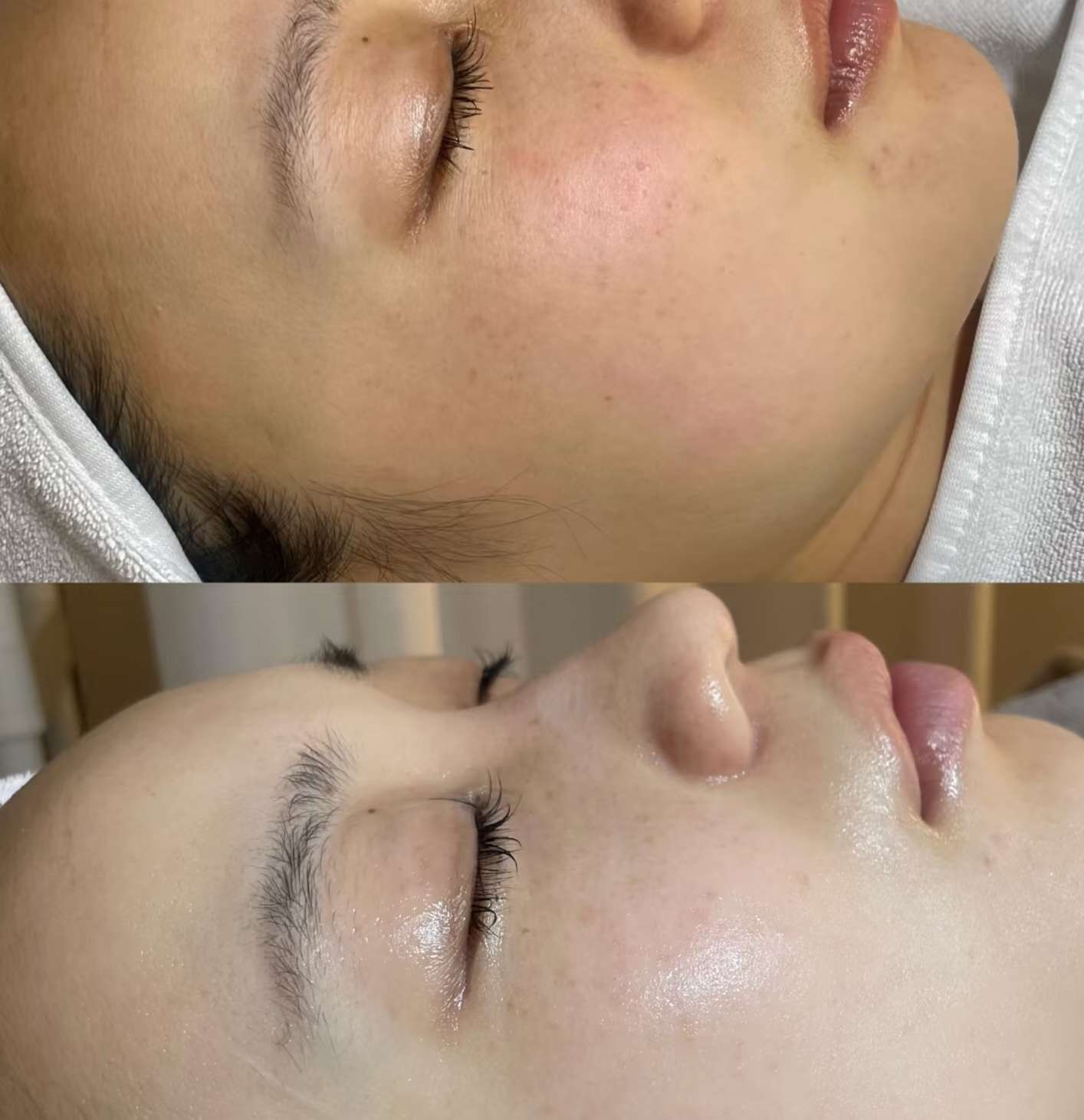 今日悉尼洗唇150次 洗唇150次