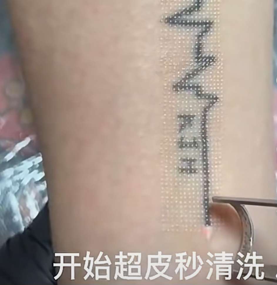 今日悉尼洗眉100刀次 洗眉100刀次