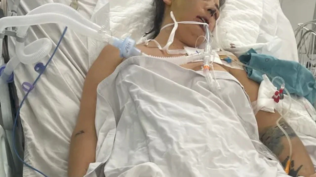 澳女越南整形失败!器官衰竭感染“食肉菌”,面部坏死缠满绷带(组图) - 2