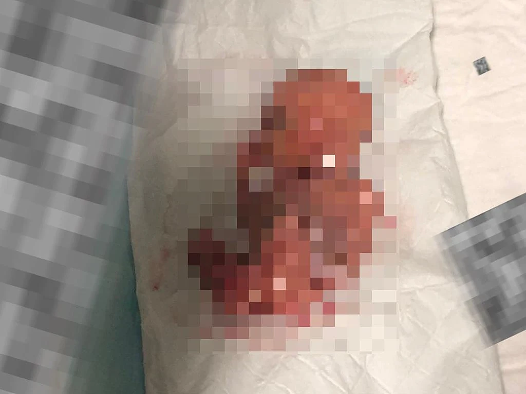 昆州医院惊现严重隐私泄露：流产胎儿照及患者信息遭疯传，官方怒斥“行为恶劣”（组图） - 3