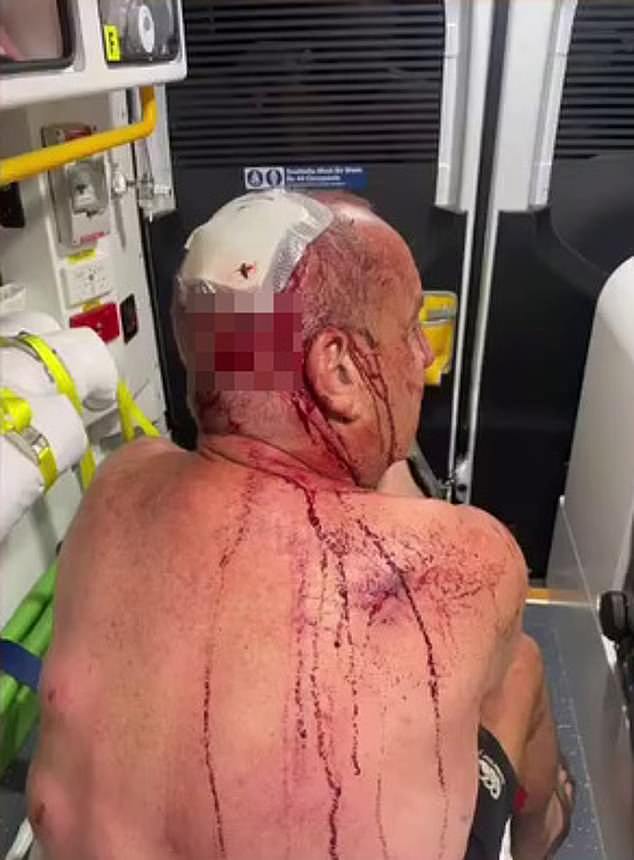 澳男勇斗袋鼠救犬，惨遭“连环踢”腹部被刺穿！直言：差点就没命了（组图） - 1