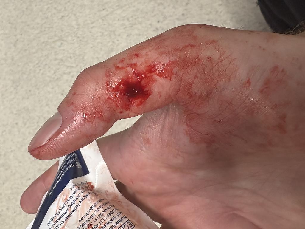 悉尼抗议者遭警员按地暴打，视频网上疯传！当局回应：他先咬警员拇指（组图） - 3