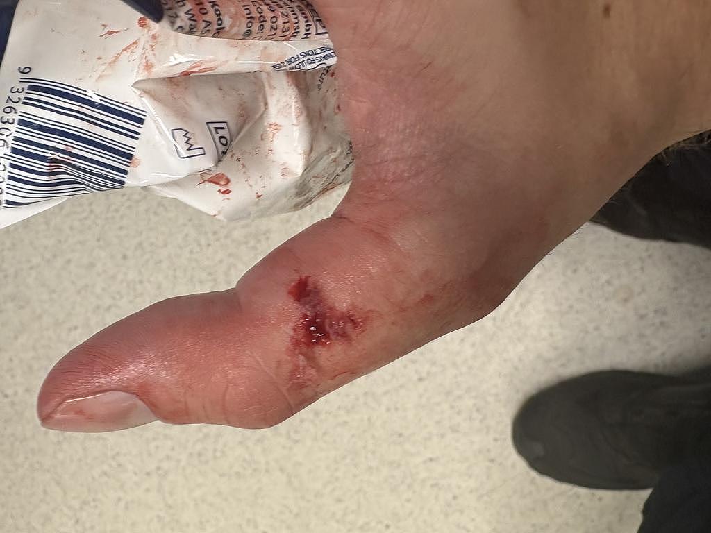 悉尼抗议者遭警员按地暴打，视频网上疯传！当局回应：他先咬警员拇指（组图） - 4