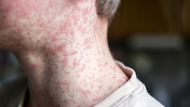 昆州病例翻倍维州紧急拉响警报！墨尔本机场及多家医院中招，这些高危时段需警惕（图） - 2