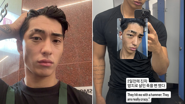 “差点被锤死！”澳CBD发生恶性持锤袭击案，亚裔游客被砸成重伤，涉案少年落网（组图） - 3