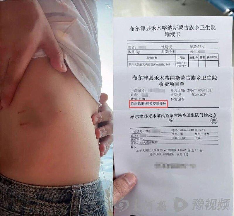 新疆阿勒泰血腥一幕！2级国家保护动物赤狐咬人，疑在雪场被打死（组图） - 2