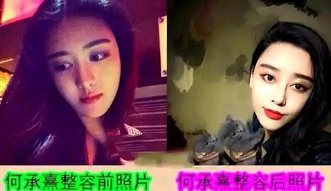 10年前，富家女花800万整成范冰冰，嫁主刀医生后，现在成这样（组图） - 3