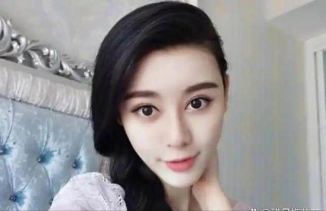 10年前，富家女花800万整成范冰冰，嫁主刀医生后，现在成这样（组图） - 8