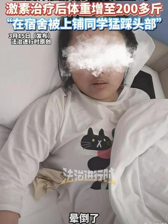 山西14岁女童疑遭同学施暴踩头欺凌，颅脑严重损伤智力退化至3岁（组图） - 4