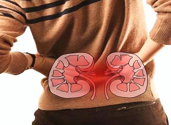 一周至少20次!57岁男子肾衰竭,妻子:劝了很多次,就是不听?(组图) - 1