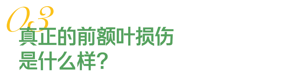 “我的前额叶罢工了”，年轻人争相确诊脑残网红病（组图） - 12