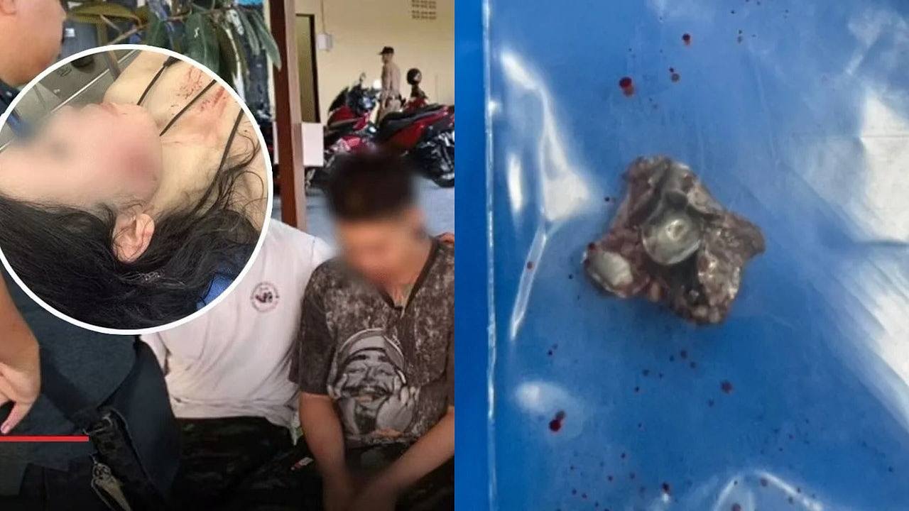 中国游客脸部中弹!射击场意外走火,涉事员工被控两项罪名(组图) - 1