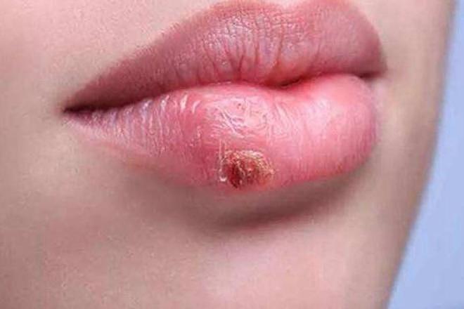 几块钱的维生素B2,竟是高血压克星?提醒:还有助改善性生活(组图) - 9