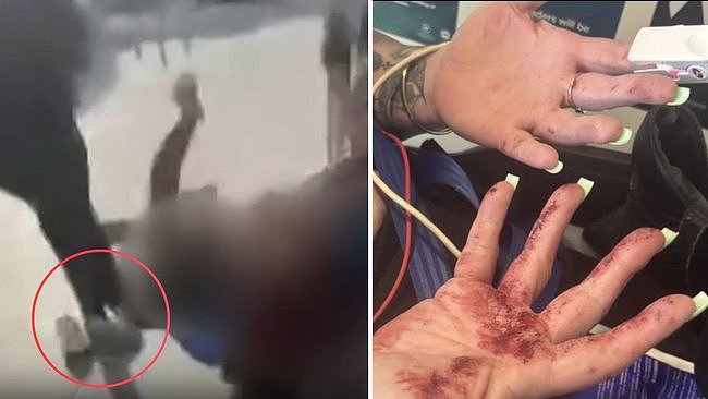 “我绝不道歉！”澳洲母亲商场混战踢人头部，称为了“反击霸凌”（组图） - 1