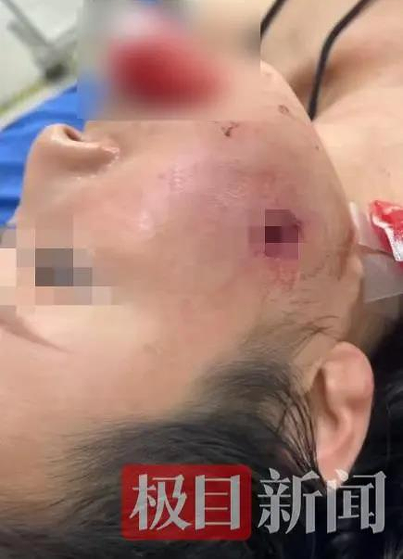 泰射击场枪枝走火,中国女游客脸被射穿!子弹卡舌头(组图) - 1
