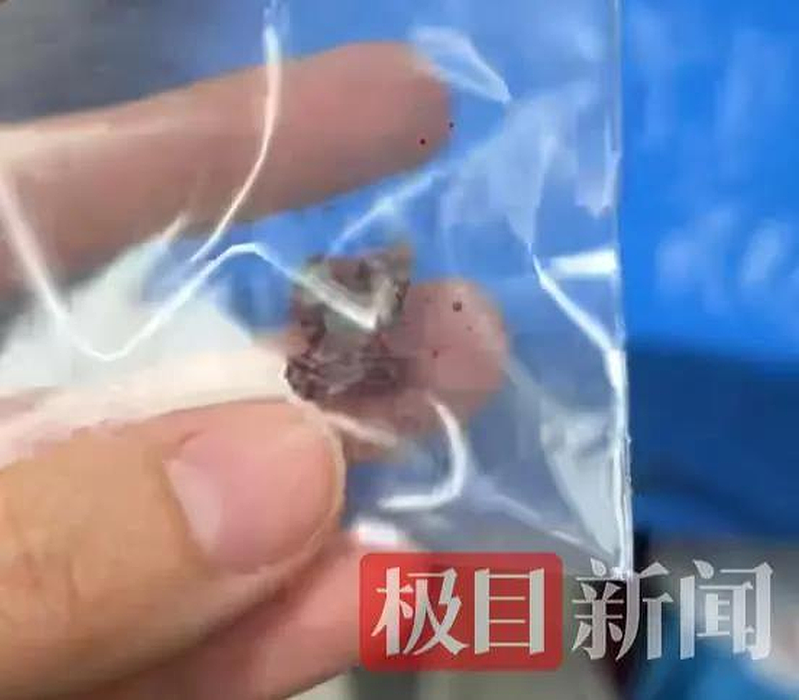 泰射击场枪枝走火,中国女游客脸被射穿!子弹卡舌头(组图) - 2