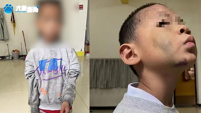 继母烫幼子下体逼吃大便，姐弟惨遭虐待生母怒讨说法（组图） - 3