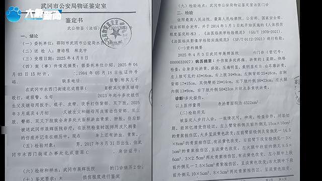 继母烫幼子下体逼吃大便，姐弟惨遭虐待生母怒讨说法（组图） - 4