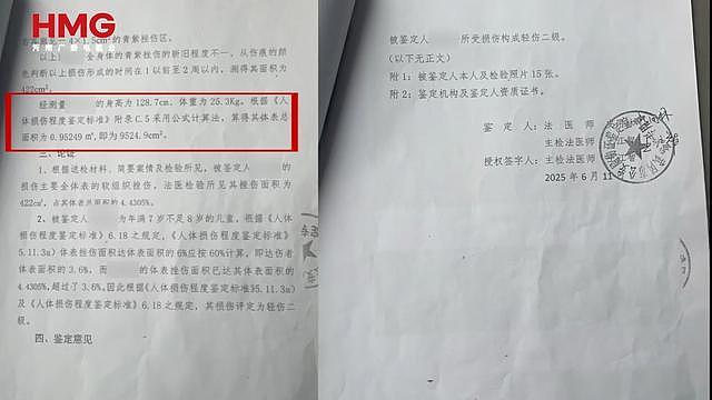 继母烫幼子下体逼吃大便，姐弟惨遭虐待生母怒讨说法（组图） - 5