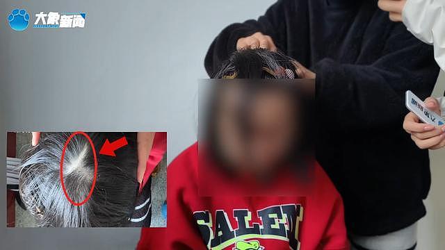 继母烫幼子下体逼吃大便，姐弟惨遭虐待生母怒讨说法（组图） - 7