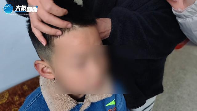 继母烫幼子下体逼吃大便，姐弟惨遭虐待生母怒讨说法（组图） - 8