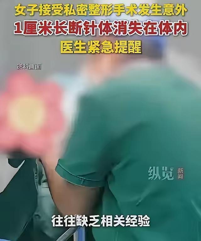 被吓到！35岁陈女士，花几万块买私处“紧致”，结果针断在里面了（组图） - 1