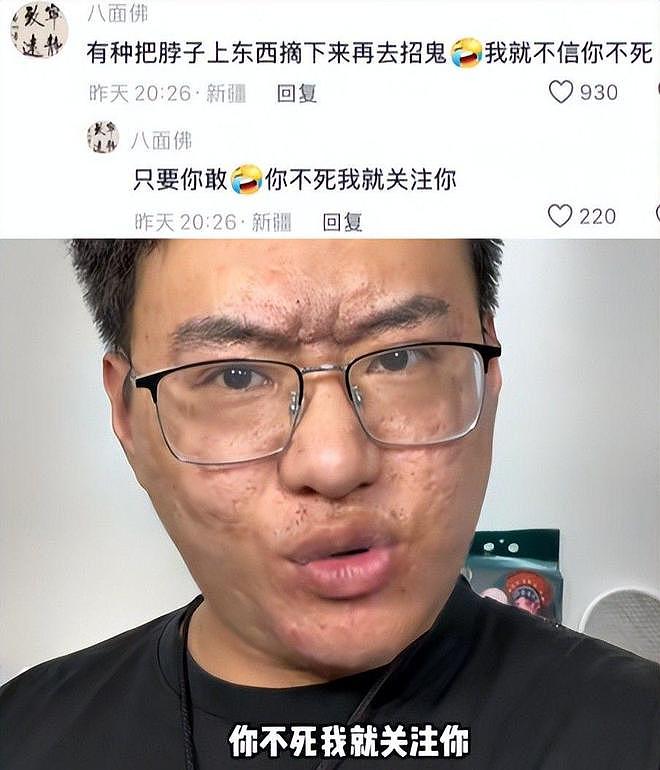 面相大变?那个砸神像、睡坟场“八字命硬”的网红,如今差别太大(组图) - 13