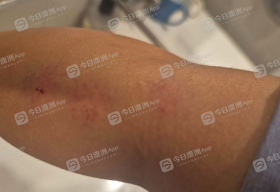 愤怒！澳洲华女遇种歧辱骂，被暴打至浑身是血，由救护车送院！悍妇更持刀威胁，一走了之（视频/组图） - 5