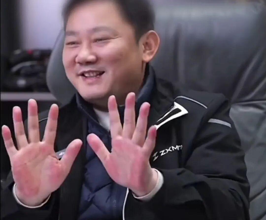 张雪因手掌太红被网友提醒及时就医！此前回应：肝没问题（组图） - 1