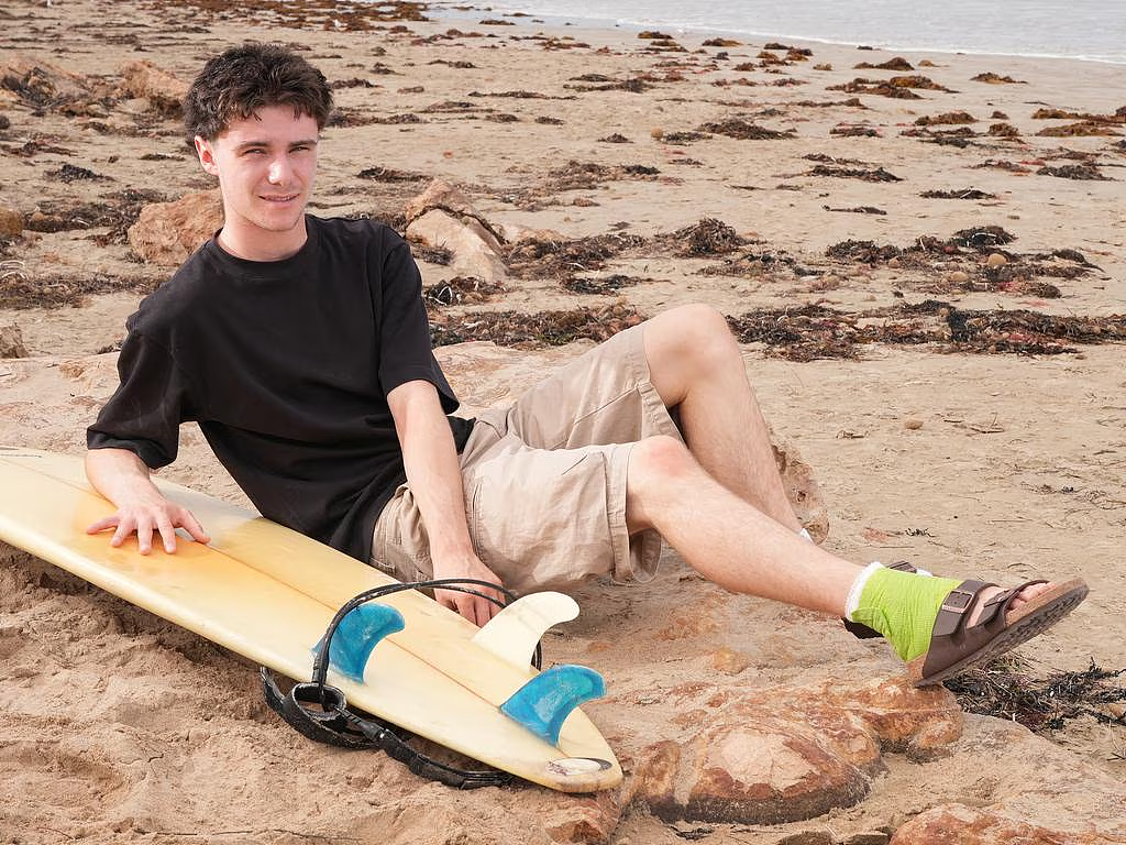 “我当时感觉要完了！”澳16岁少年冲浪遭鲨鱼撕咬，死里逃生游回岸边 - 2