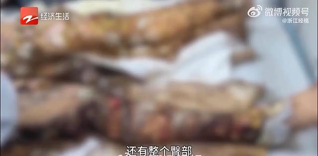 男子骑电动车带妻子去接孩子，途中车底锂电池突然爆燃，火焰瞬间吞没车身，后座的妻子沦为火人 - 1