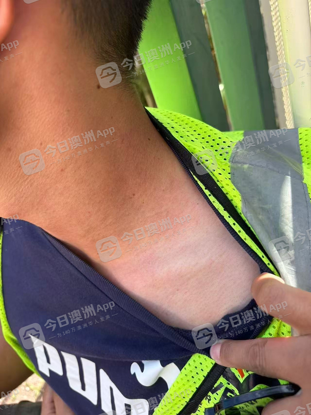 “今天要打死你！”澳洲华人送货司机曝遭中餐馆东主挥棍殴打，浑身是伤！老板娘：“诽谤！是一面之词”（组图） - 8