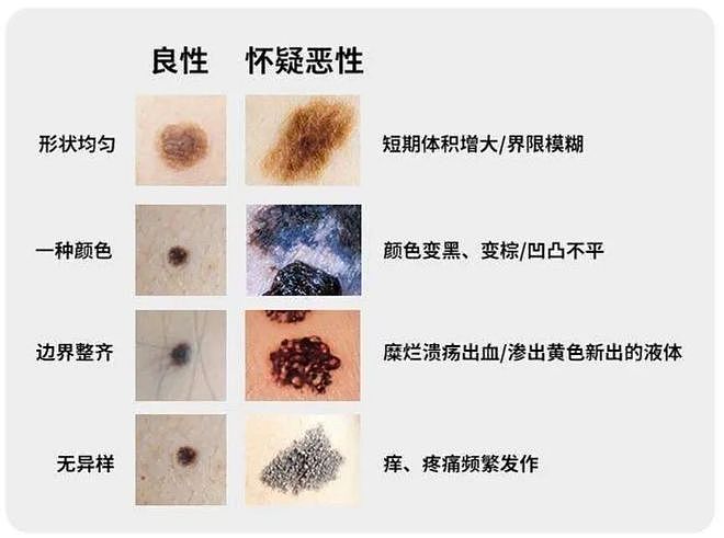 什么？宋雨琦胸口这颗痣值800万？（组图） - 15