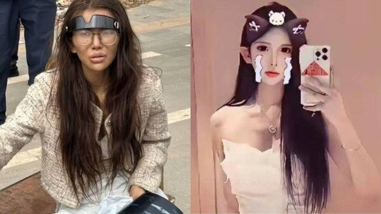 网红柬埔寨死里逃生断双腿!直播亲揭卖猪仔内幕,两帐号突遭封禁(组图) - 1