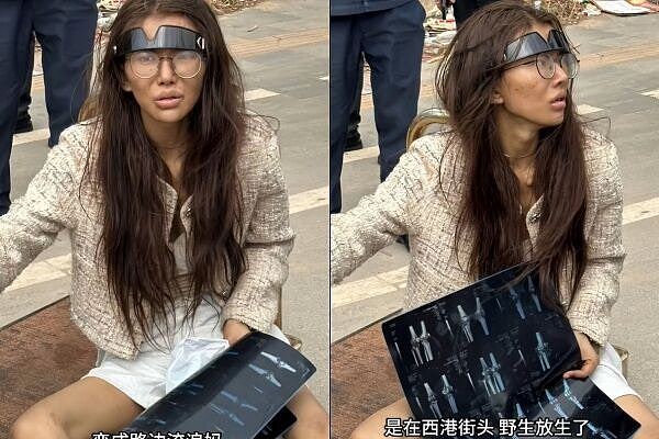 网红柬埔寨死里逃生断双腿!直播亲揭卖猪仔内幕,两帐号突遭封禁(组图) - 2