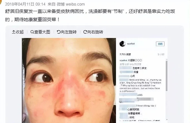 一周内4位女星因病就医!熬夜与过度减脂惹祸(组图) - 34