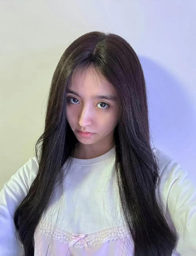 金子涵直播疑似求救：脸部被注射50针不明物质，不服从便会头痛 - 1