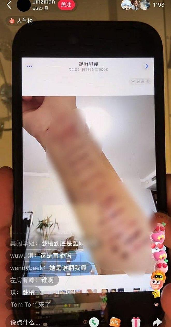 金子涵直播疑似求救：脸部被注射50针不明物质，不服从便会头痛 - 5